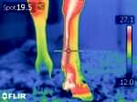 Thermal Equine Survey, Mites Infesting the foot